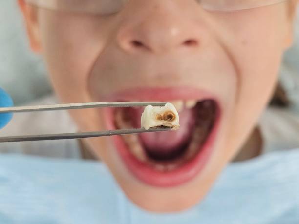 Best Urgent Dental Care for Toothache in Lenoir, NC